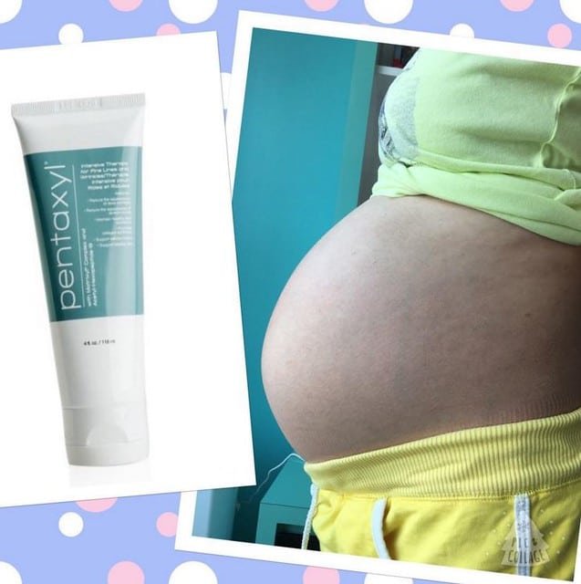Pentaxyl review pregnancy bump stretch mark routine photo by @allyourfamilyneeds
